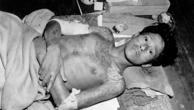 80 Yıl Sonra Nagasaki'den Uyarı: Nükleer Riskler Yeniden Gündemde