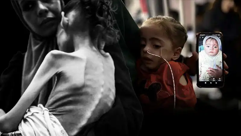 Küçük Meryem’in Dramı: 25 Kilodan 10 Kiloya Düştü, Açlıkla Savaş Veriyor!